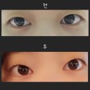 다롱뷰티 | 기흥역 다롱뷰티 속눈썹펌 후기