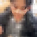 정용기 | [비중격만곡증] 삼성서울병원 정용기 교수님 | 비중격만곡증 수술+코끝 성형 후기 내돈내산