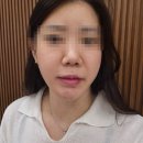 제이에스(JS)피부연구소 | 검단피부관리 잘하는 곳 '제이에스JS에스테틱' 방문후기 웨딩관리추천