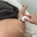 상남동133 | 창원 상남동 제뉴인 에스테틱, 하이퍼소닉을 이용한 어깨 통증 관리 후기