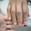 로더네일