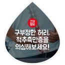 구부정한 허리와 삐둘어진 신체 , 척추 측만증의 대표증상과 치료법 이미지