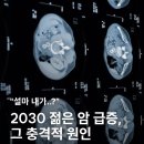 20대~30대 젊은 암환자 숫자가 급증한 이유 이미지