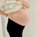 쌍둥이 조기양수파열 그리고 자연분만 (강남차병원)