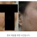 백피부과의원 | 일산피부과의원, &#39;이렇게&#39; 선택하셔야 합니다.