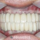 애프터기공소 이미지