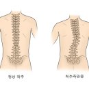 애룰바디 이미지
