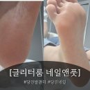 네일혜니 | 당진발관리 전문 [글리터룸 네일앤풋] 발바닥 각질관리 후기