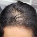 블랭크smp 이미지