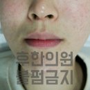 대유한의원 | 원주여드름치료, 피부과와 한의원은 어떤 관점이 다를까요?