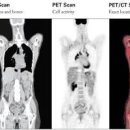 PET CT 검사 금식 시간 비용 결과 부작용 펫시티 알아야 할 정보는 이미지