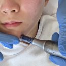 에이스메디칼 | 여의도 에스테틱 추천 에이스킨 여의도점 여드름압출후기