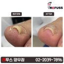 레푸스 망우점