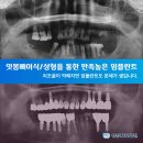 웰메이드덴탈 | 범계치과 대세가 바뀌었어요!