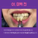 강남더밝은치과의원 이미지