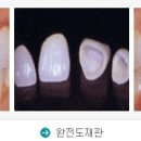 노박치과의원 네이버블로그