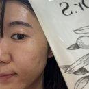 주식회사 리젠케어 | 수분크림추천 피부 진정까지 되는 닥터에스리젠크림 사용후기