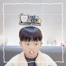 시기 | 아이 첫니 빠지는 시기 발치후기