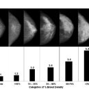 유방암과 제니스테인(Genistein), 암줄기세포(Cancer Stem Cell) 자연치료 (2) 이미지