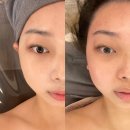 동익상가화장품 | 고양동 피부관리 '화이트닝스킨케어' : 춤추는 성형 윤곽관리 후기
