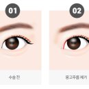 꼼꼼성형외과의원 이미지