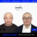 임플레오