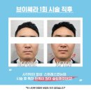 바비앤죠스킨케어