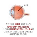 눈플러스안경원 네이버블로그