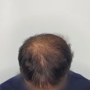 디비전 스칼프 이미지