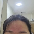 태인 | 수험생 어깨·허리 통증, 엄마 추천으로 찾은 춘천태인한의원 후기