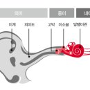 제일의료기보청기 이미지