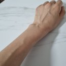 원정형외과의원 | 사당정형외과의원, 손목건초염 드퀘르뱅 치료후기