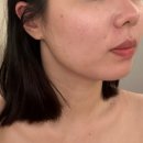 엠제이(MJ)헬스케어 | [대림역피부관리] 1:1 맞춤관리잘하는곳 &#34;엠제이뷰티&#34; 더마 리쥬브케어로 영양흡수와 재생관리까지