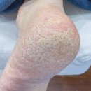 성화약국 | 부모님 효도 선물? 발관리 추천하는 이유