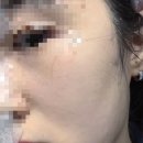 아비브 | 쿠팡 화장품 추천템, 아비브 마스크팩 마데카소사이드 진정 시트 후기