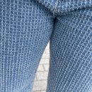 코코성형외과의원 네이버블로그