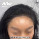 돕스칼프 이미지