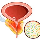 전립선에 좋은 음식 12가지 챙겨먹자 이미지