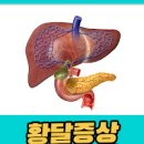 췌장암 초기 췌장암 등통증 위치 원인 말기 이미지