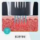 아르스킨의원 | [홍대 피부과 아르스킨의원] 내돈내산 의사들 많이 받는 포텐자 엑소좀 LDM 시술 후기 효과 주의사항