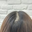 가비뷰티랩 | [분당 SMP] 예비신부 정수리 고민엔 분당 최초 smp 전문샵 "가비뷰티랩"ㅣ위치, 전후비교, 솔직후기