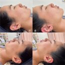 더 타이어샵 옥계점 | 구미 에스테틱 꿀광 피부 관리 스킨이혈테라피 옥계 730스킨 방문 후기
