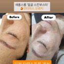 미인케어광교 | 피부 진짜 좋아지고 싶다면? 치어리더 김해리도 다니는 ‘광교 새롬스룸’ 비밀공개..