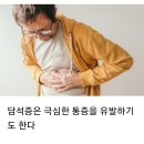 갑작스러운 복통과 황달~~ 혹시 담석증? 이미지