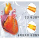 고혈압의 합병증 이미지