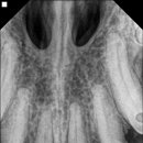 디지레이 이미지