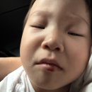 3살 아이 입술 안쪽·입술 밑 봉합술 후기｜부산 수의원 응급진료