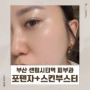 밀크스킨 | 부산 해운대 우동 피부과 모공관리 포텐자+밀크엑소좀 스킨부스터 통증 후기