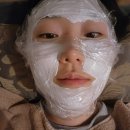 단식광대 | [노화] 써마지, 쥬베룩 볼륨, 울트라콜, 옆광대 발달형(땅콩형) 얼굴 개선을 위한 노력 1탄