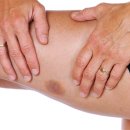 양이멍이 이미지